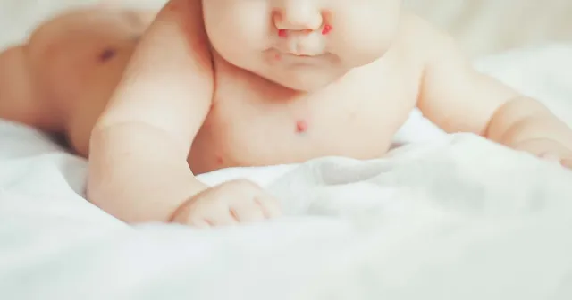 Children's Skin