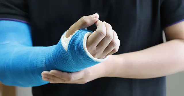 Fracture Center
