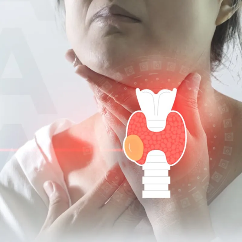 Thyroid Radiofrequency Ablation Package