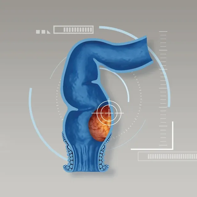 Colorectal Surgery Clinic Package